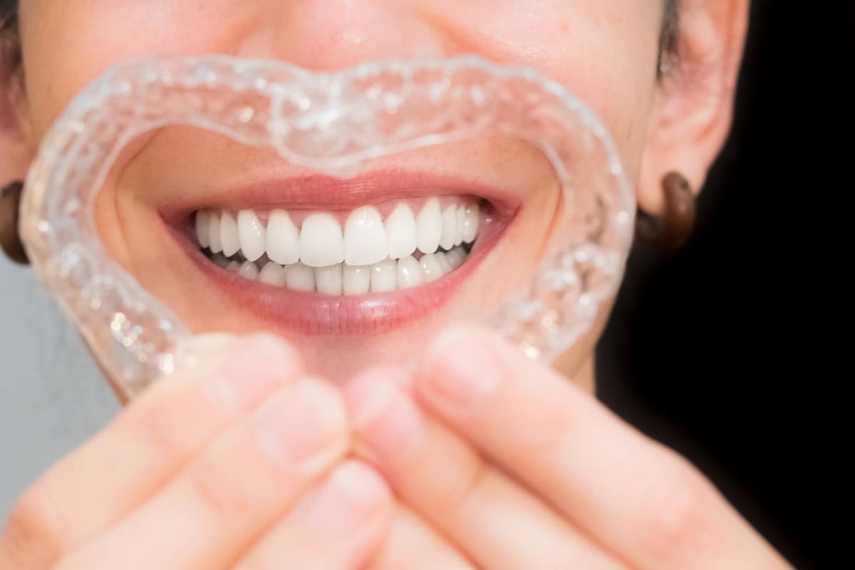 Invisalign Vs Braces Which Option Is Best Blog